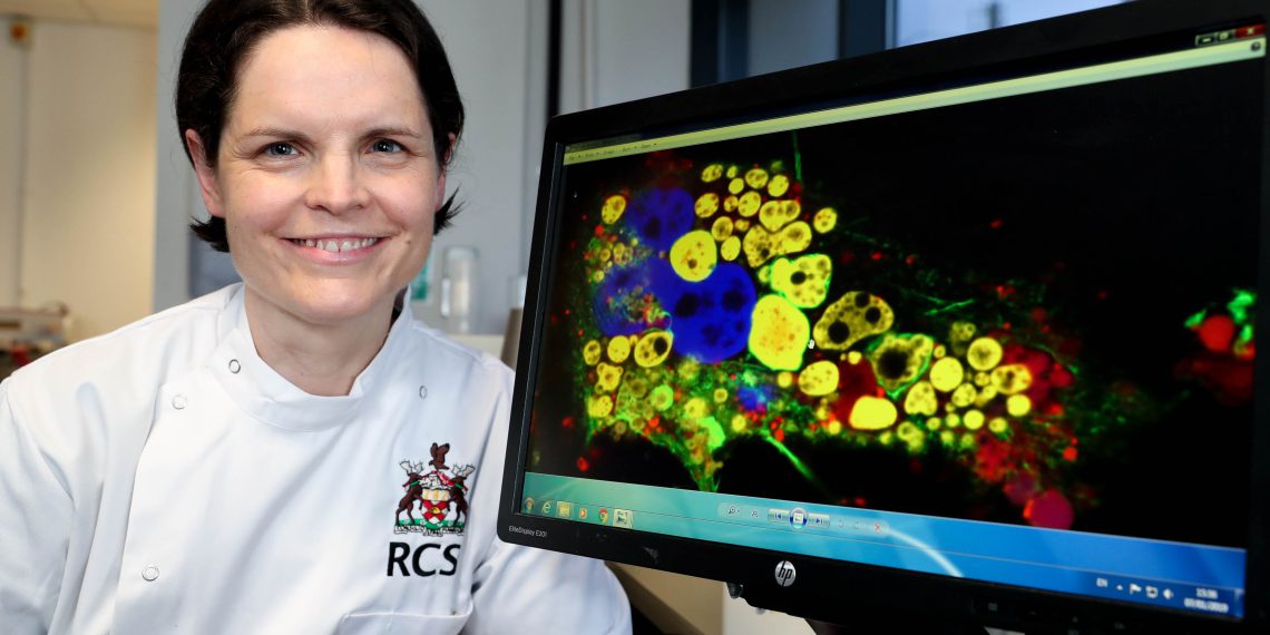 RCSI researchers develop new tuberculosis treatment maxwellphotography